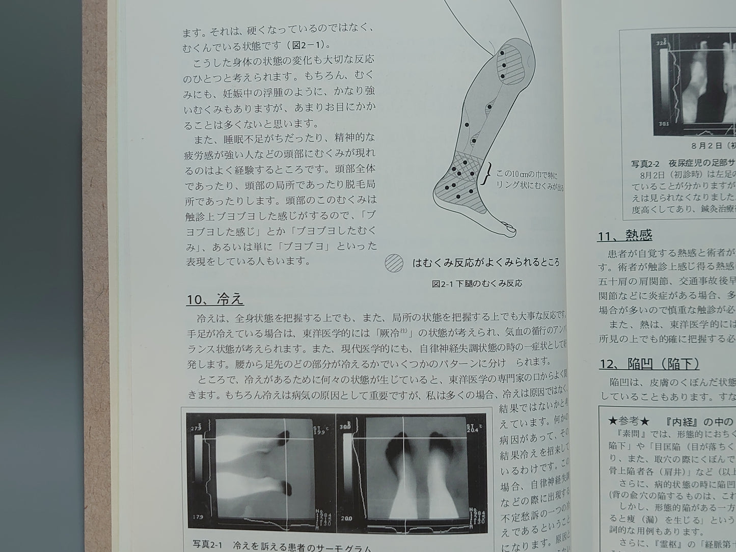 221 治療家の手の作り方 反応論・触診学試論